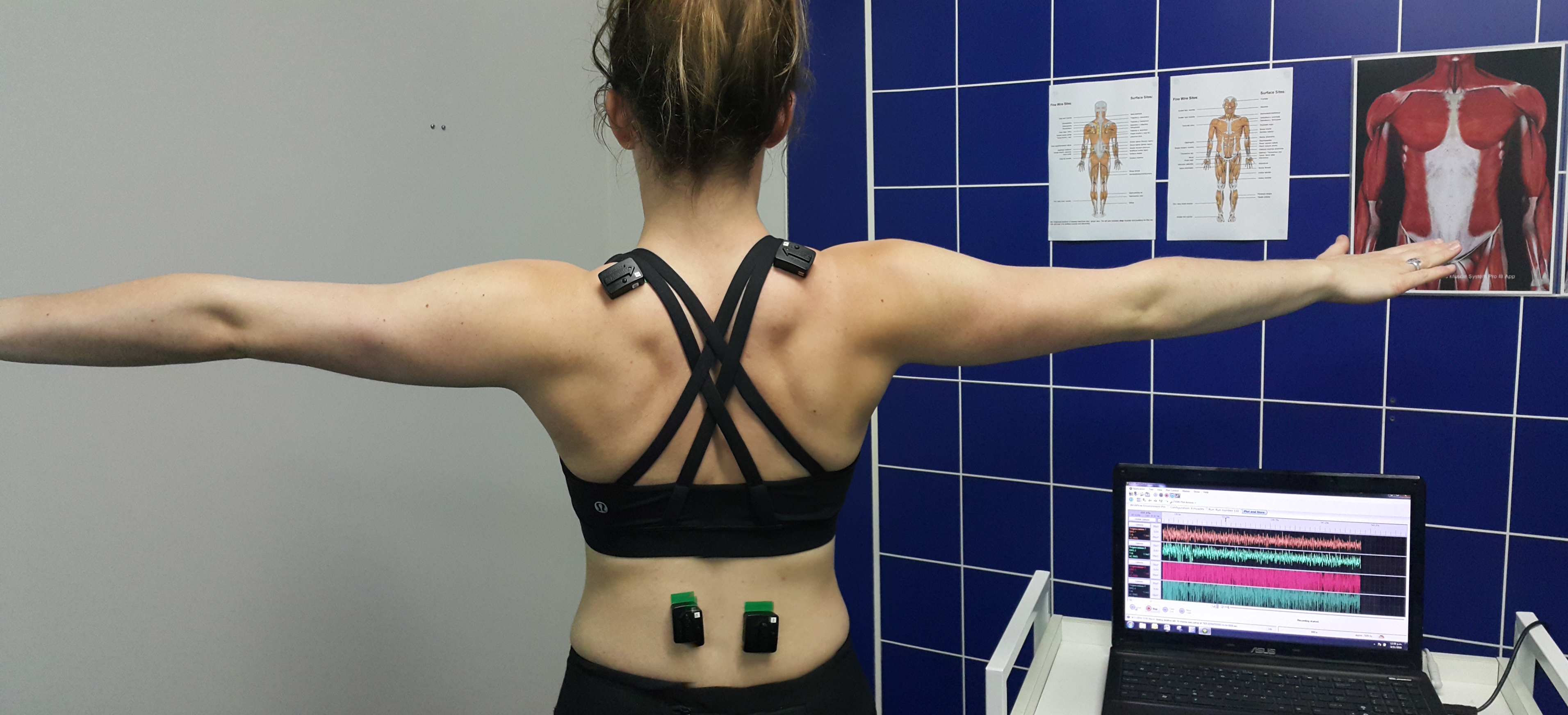 how painful is an emg test